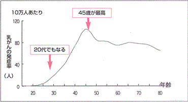 １１人に１人がなる乳がん