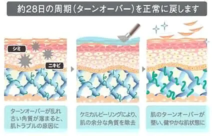 ケミカルピーリングの作用