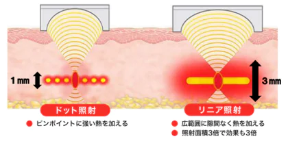 ヨニハイフリニア